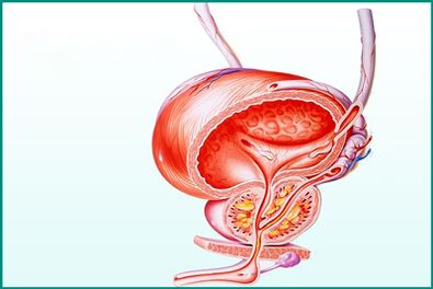 Keradangan prostat dalam prostatitis akut adalah had untuk seks