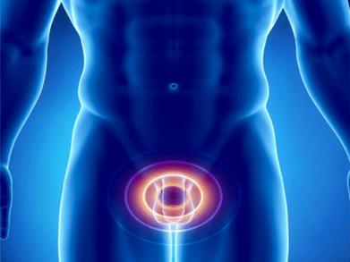 Prostatitis - keradangan kelenjar prostat pada lelaki