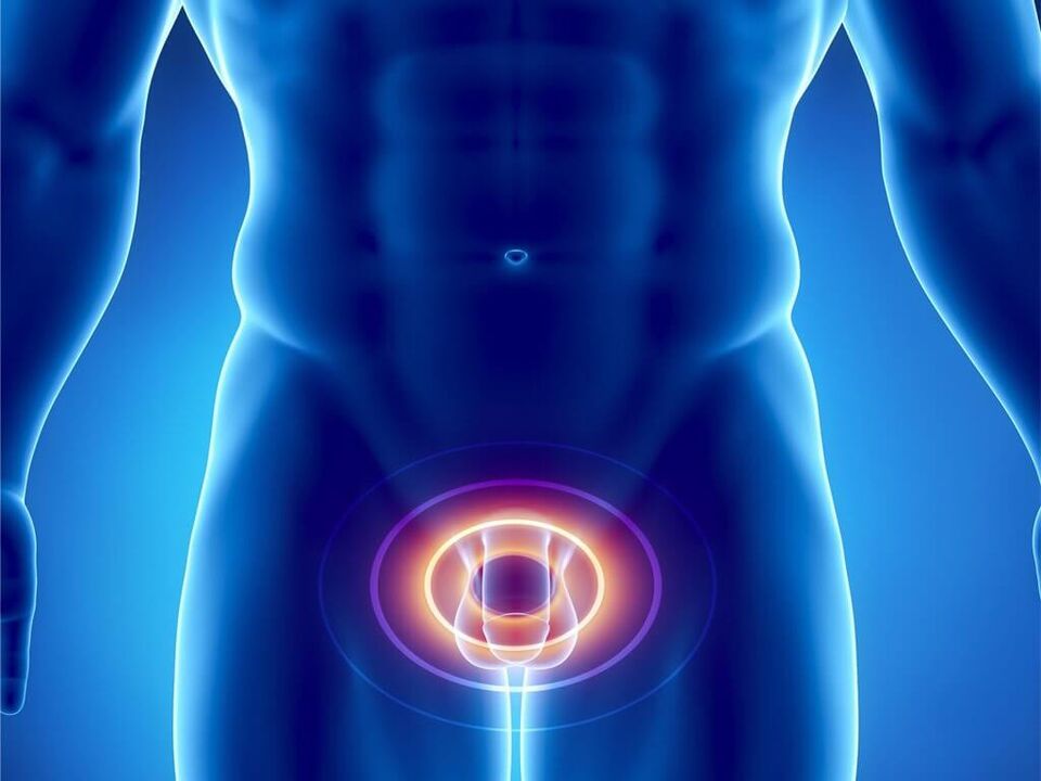 gejala prostatitis pada lelaki